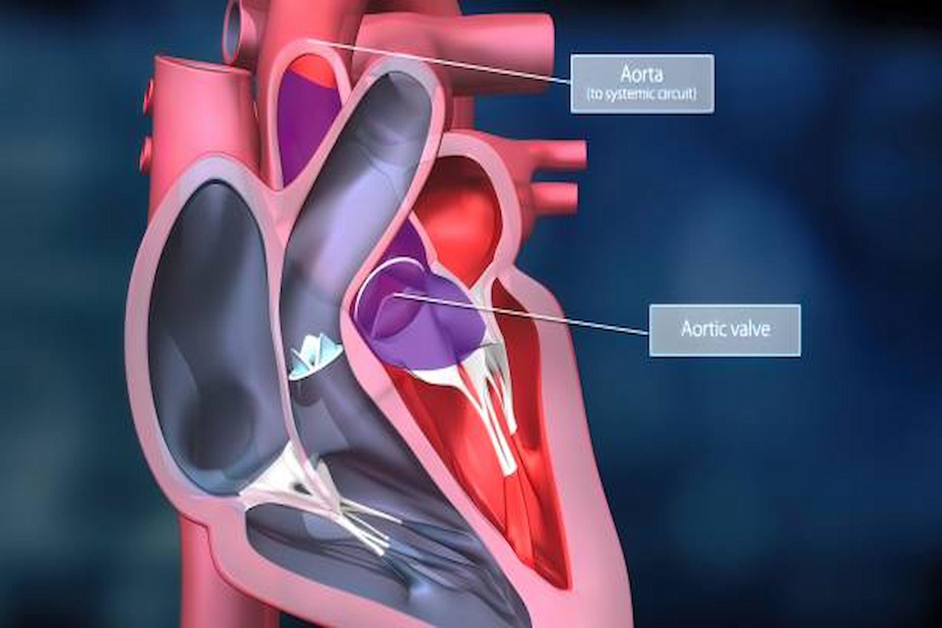 What Can You Expect From Your Heart Surgery