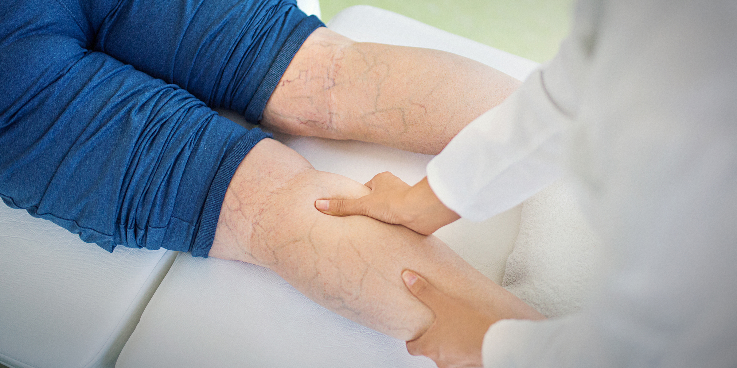 What Are The Different Kinds Of Varicose Treatments
